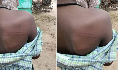 உசிலம்பட்டி அருகே அரசு பள்ளி ஆசிரியை பிரம்பால் அடித்ததில் மாணவர்கள் காயம்