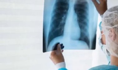 மாதங்களுக்குள் 20% குறைந்த இறப்பு... காசநோயை ஒழிப்பதில் தமிழ்நாடு முன்மாதிரியாக செயல்படுவது எப்படி?