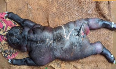 உளுந்தூர்பேட்டையில் மனித முக தோற்றத்துடன் பிறந்த ஆட்டுக்குட்டி